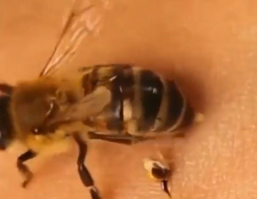 Un video viral revela la complejidad de las picaduras de abejas y por qué son tan dolorosas